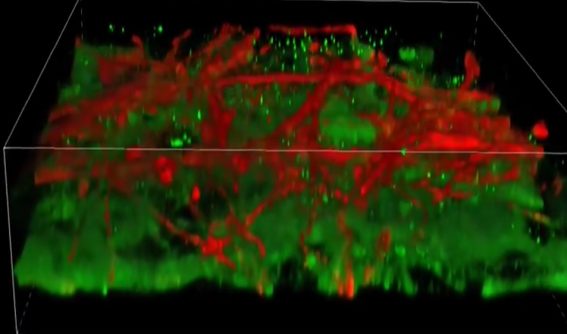 New Technique Allows 3D Printing of Functional Brain Tissue – Securities.io
