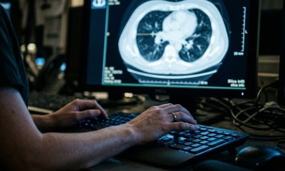 Tagrisso Plus Orpathys Improves PFS in First-Line Lung Cancer