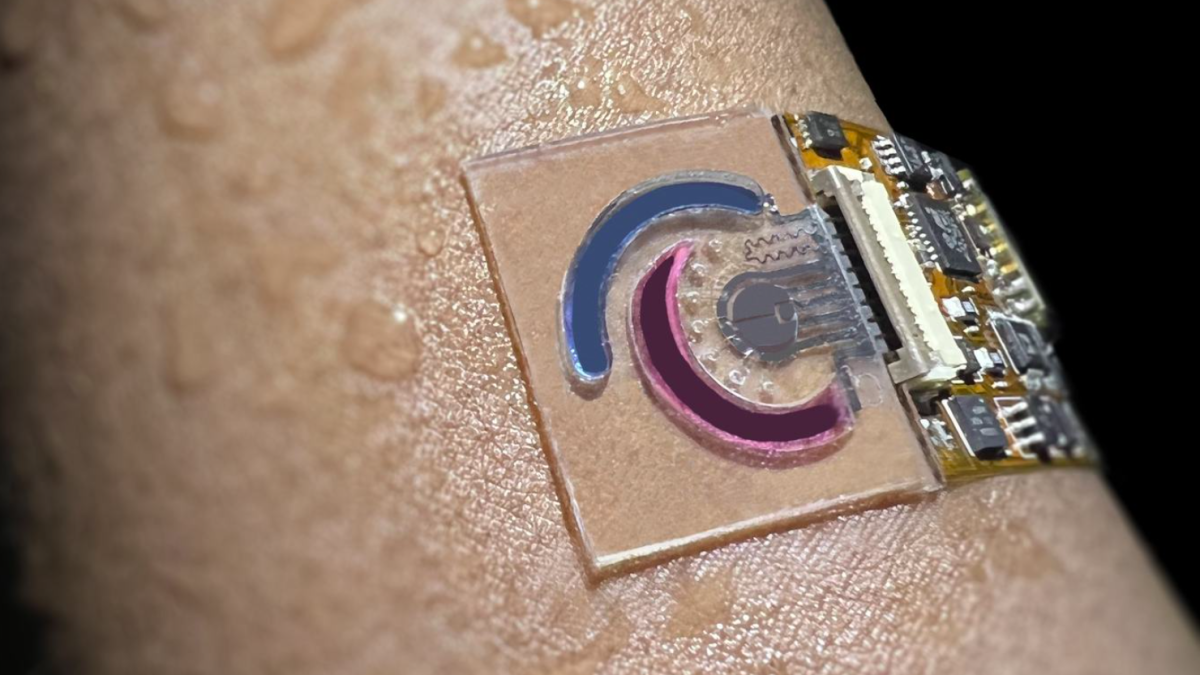 Sweat Sensors Bring Arthritis Monitoring Closer to Home