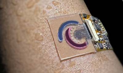 Sweat Sensors Bring Arthritis Monitoring Closer to Home