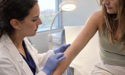 Novartis Wins FDA Approval for Rhapsido in Symptomatic Dermographism